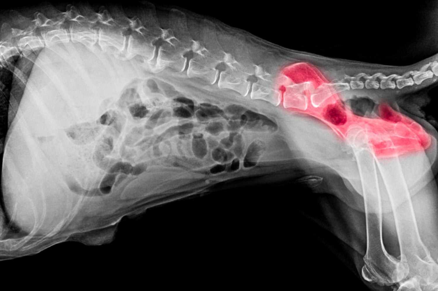 How Glucosamine Works for Joint Pain Relief